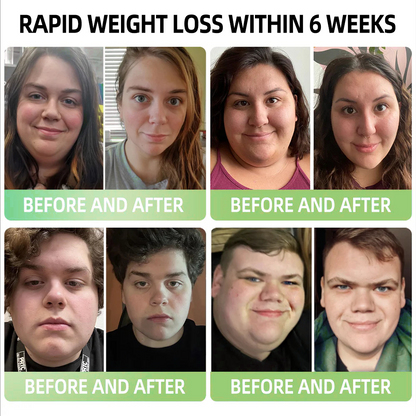 Official Store |𝐓𝐡𝐨𝐧𝐞𝐬𝐫® 𝐆𝐋𝐏-𝟏 𝐀𝐩𝐩𝐥𝐞 𝐂𝐢𝐝𝐞𝐫 𝐕𝐢𝐧𝐞𝐠𝐚𝐫 𝐆𝐮𝐦𝐦𝐢𝐞𝐬💐——Effective Measures for Preventing Chronic Diseases 🌿