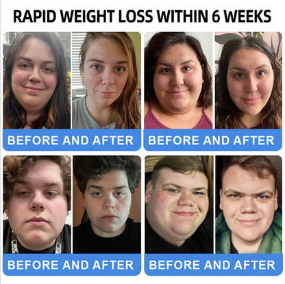 【Last Day Promotion 66% OFF🥇】𝐓𝐡𝐨𝐧𝐞𝐬𝐫® 𝐆𝐋𝐏-𝟏 𝐏𝐫𝐨+ 𝐒𝐈𝐗 𝐈𝐍-𝐎𝐍𝐄 𝐇𝐞𝐚𝐥𝐭𝐡 𝐒𝐨𝐥𝐮𝐭𝐢𝐨𝐧 𝐎𝐫𝐚𝐥 𝐋𝐢𝐪𝐮𝐢𝐝 💪Use once every two days, | Lose 20 pounds quickly | Reduce sugar by 90% |)