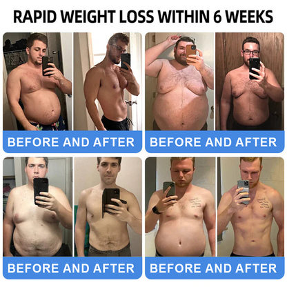 【Last Day Promotion 66% OFF🥇】𝐓𝐡𝐨𝐧𝐞𝐬𝐫® 𝐆𝐋𝐏-𝟏 𝐏𝐫𝐨+ 𝐒𝐈𝐗 𝐈𝐍-𝐎𝐍𝐄 𝐇𝐞𝐚𝐥𝐭𝐡 𝐒𝐨𝐥𝐮𝐭𝐢𝐨𝐧 𝐎𝐫𝐚𝐥 𝐋𝐢𝐪𝐮𝐢𝐝 💪Use once every two days, | Lose 20 pounds quickly | Reduce sugar by 90% |)