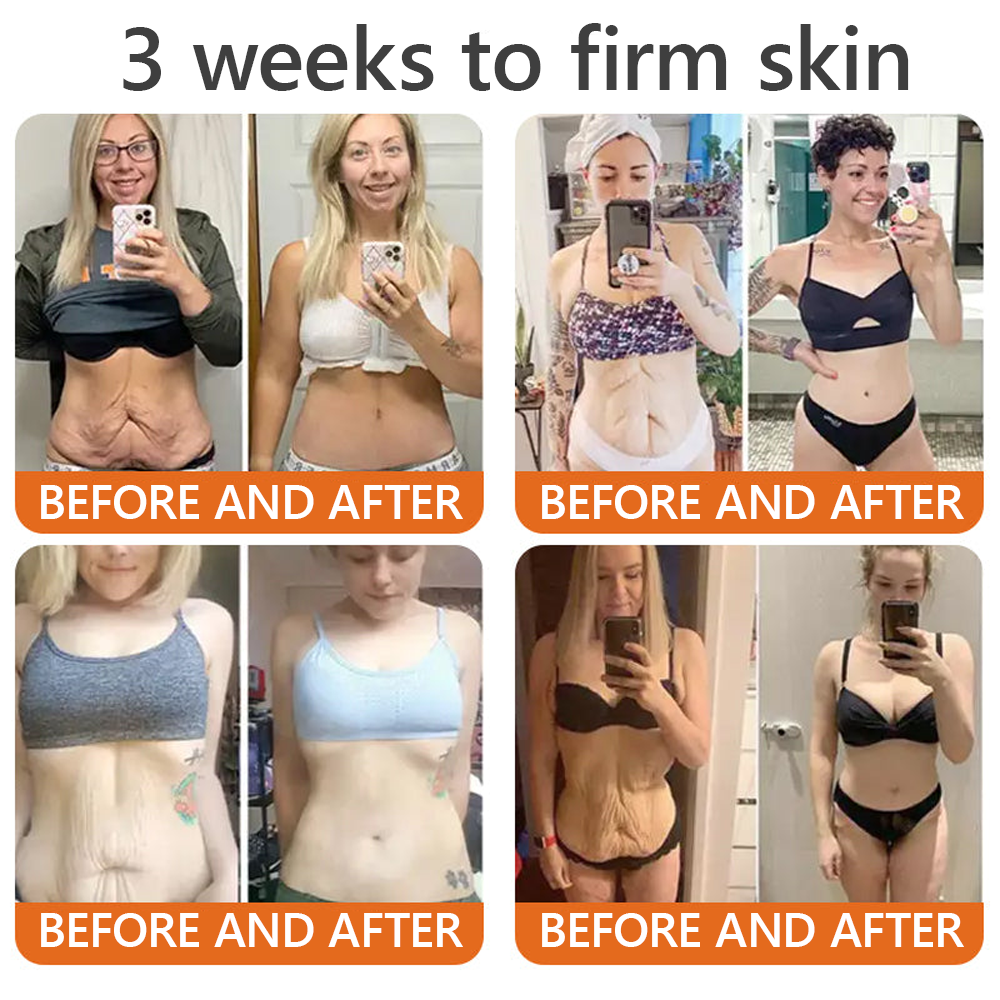 EQVP® 𝘽𝙀𝙀 𝙑𝙀𝙉𝙊𝙈 𝑺𝒌𝒊𝒏 𝑹𝒆𝒔𝒕𝒐𝒓𝒂𝒕𝒊𝒐𝒏 𝑪𝒓𝒆𝒂𝒎 –🔥 Anti-aging,Hydrating, Skin Repair, Even Tone, Acne and Dark Spot Treatment, Wart and Mole Removal, Psoriasis Relief