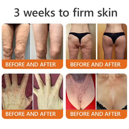 EQVP® 𝘽𝙀𝙀 𝙑𝙀𝙉𝙊𝙈 𝑺𝒌𝒊𝒏 𝑹𝒆𝒔𝒕𝒐𝒓𝒂𝒕𝒊𝒐𝒏 𝑪𝒓𝒆𝒂𝒎 –🔥 Anti-aging,Hydrating, Skin Repair, Even Tone, Acne and Dark Spot Treatment, Wart and Mole Removal, Psoriasis Relief