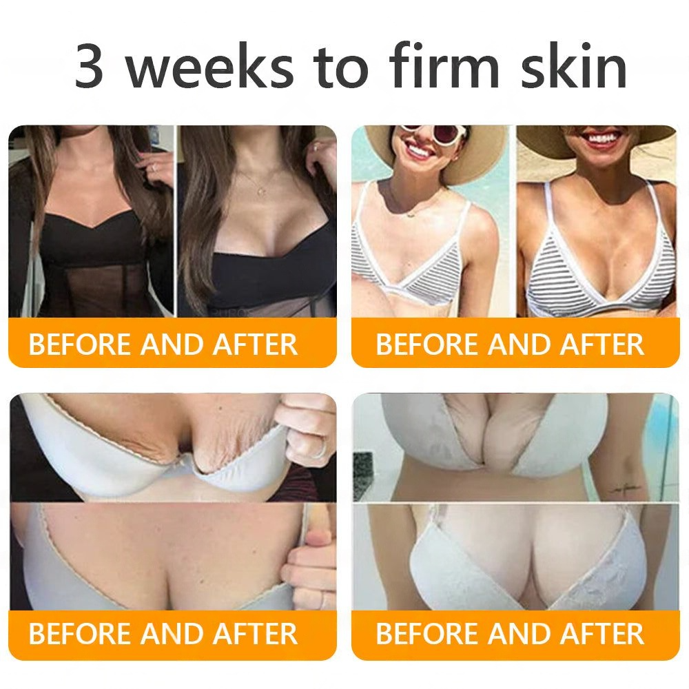 EQVP® 𝘽𝙀𝙀 𝙑𝙀𝙉𝙊𝙈 𝑺𝒌𝒊𝒏 𝑹𝒆𝒔𝒕𝒐𝒓𝒂𝒕𝒊𝒐𝒏 𝑪𝒓𝒆𝒂𝒎 –🔥 Anti-aging,Hydrating, Skin Repair, Even Tone, Acne and Dark Spot Treatment, Wart and Mole Removal, Psoriasis Relief